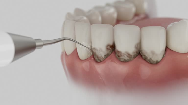 Reliable Dental Implants contractor in Fremont, MI by Smile Center Dentistry